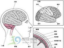 常见的癫痫病有哪些诱因