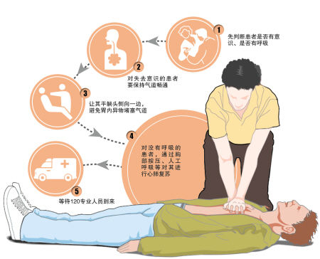 治疗癫痫病的价格费用是多少